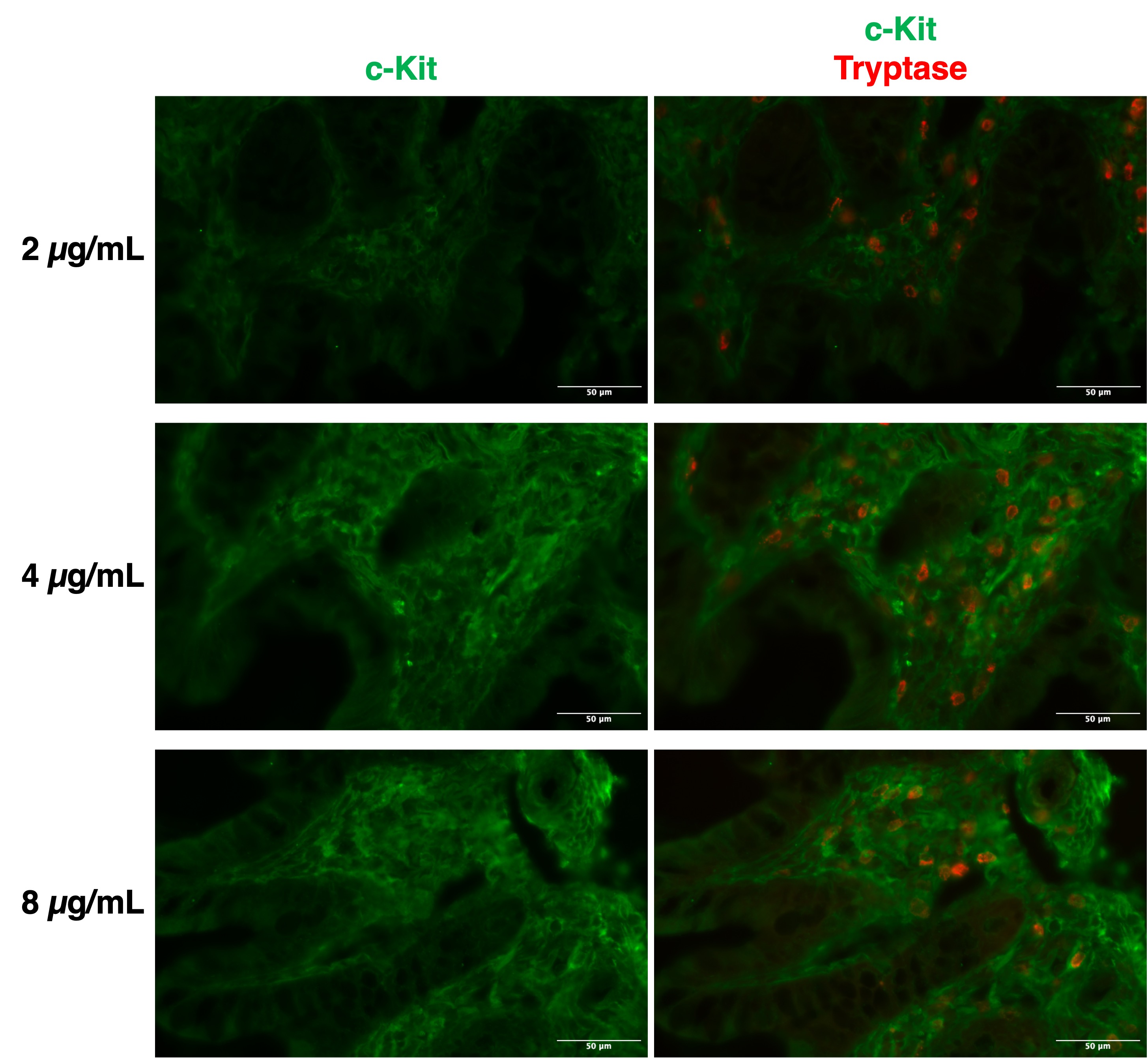 Human/Mouse CD117/c-kit Antibody AF1356