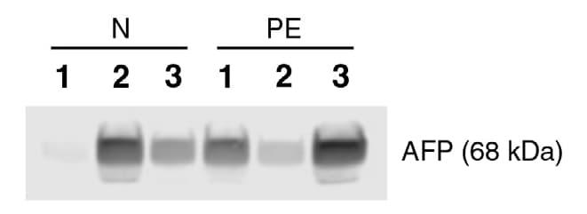 Human/Rat alpha-Fetoprotein/AFP Antibody AF1369