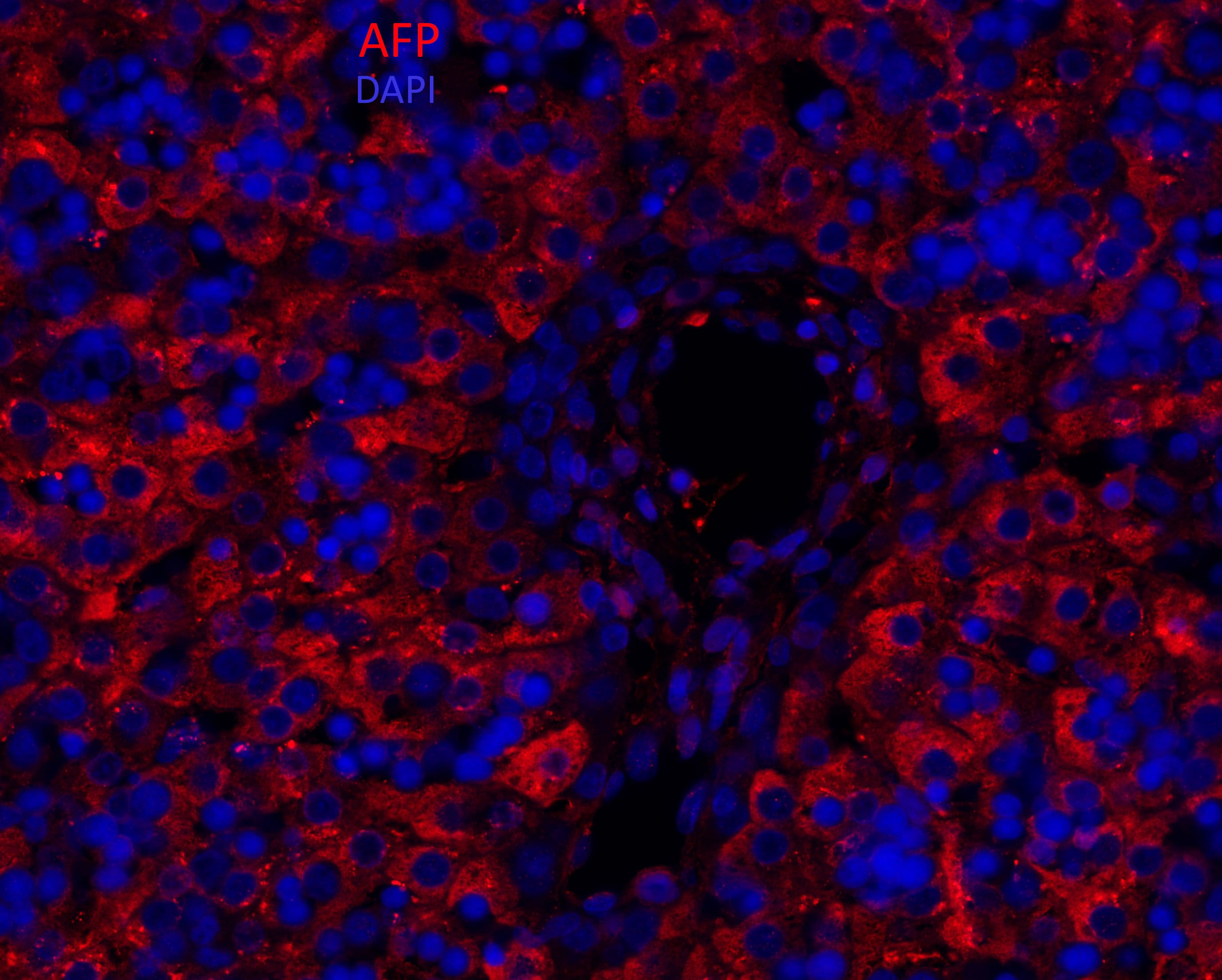 Human/Rat alpha-Fetoprotein/AFP Antibody AF1369