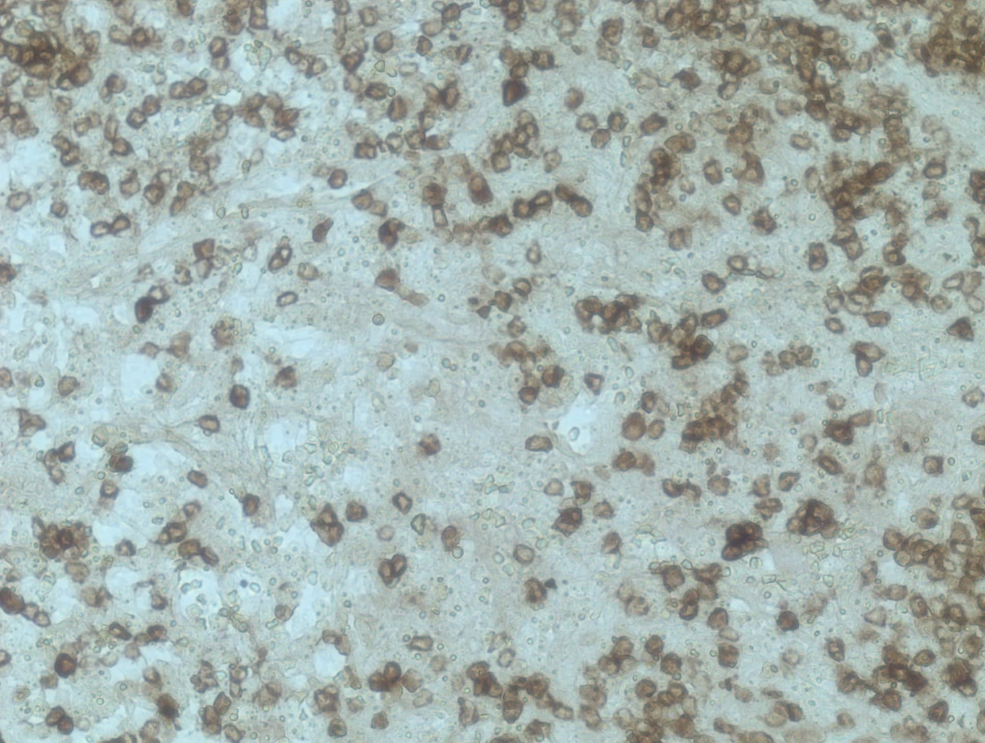 Human DLEC/CLEC4C/BDCA‑2 Antibody AF1376