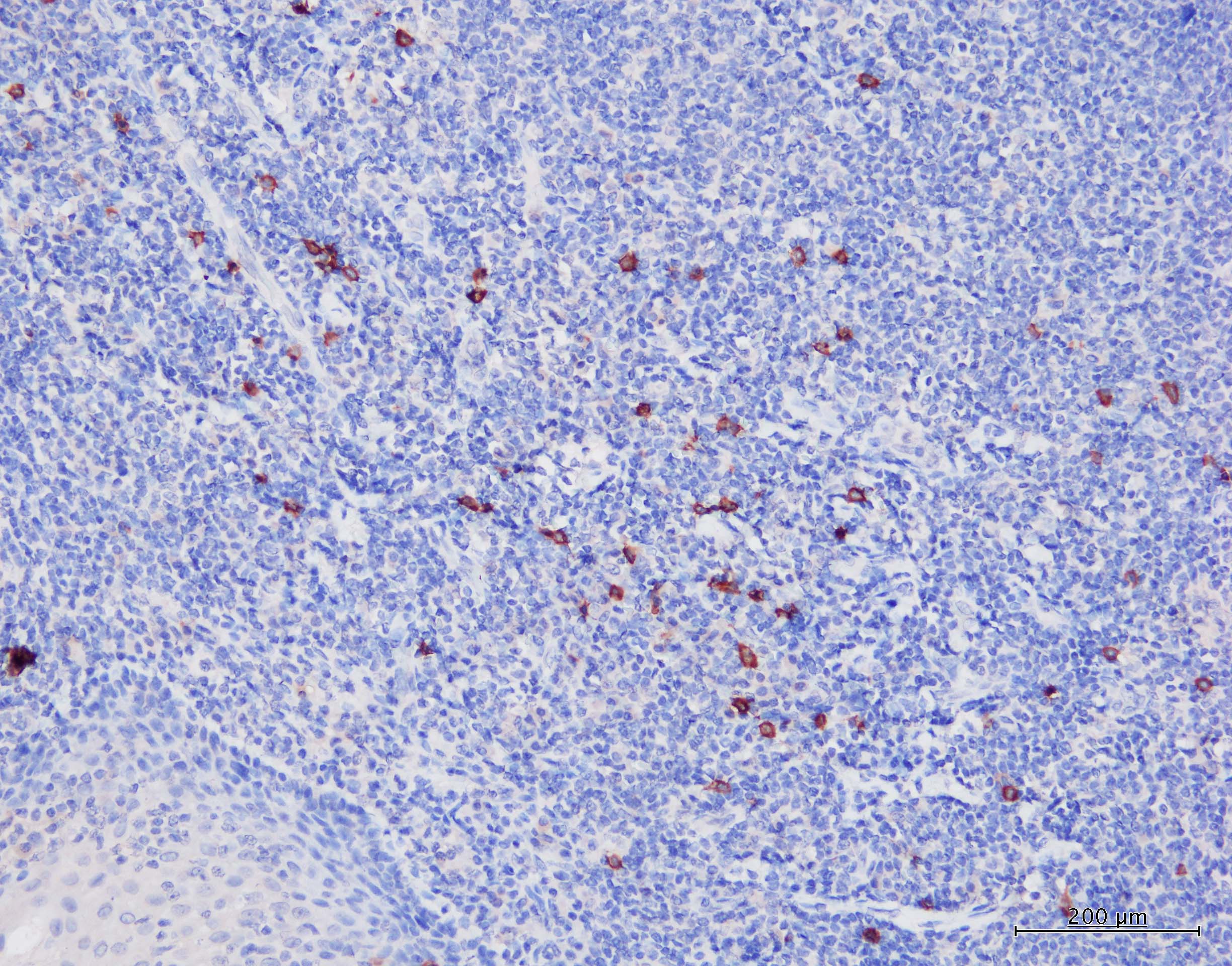 Human DLEC/CLEC4C/BDCA‑2 Antibody AF1376