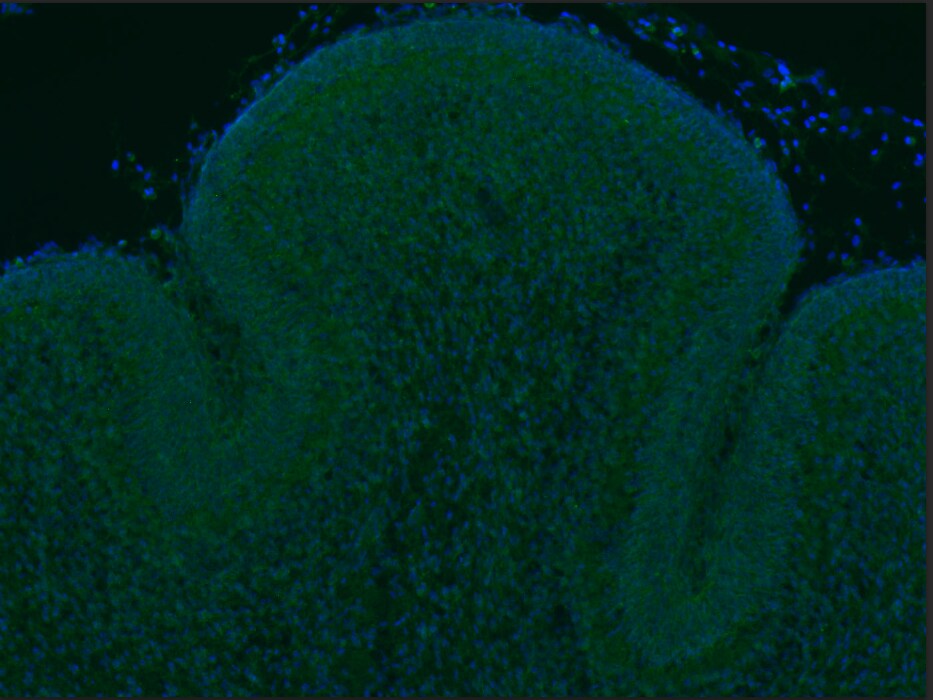 Human sFRP‑1 Antibody AF1384