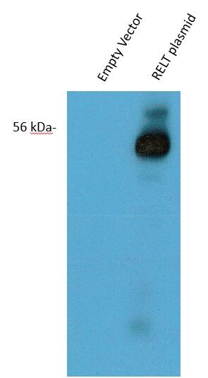 Human RELT/TNFRSF19L Antibody AF1385