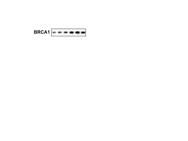 Human Phospho-BRCA1 (S1423) Antibody AF1386