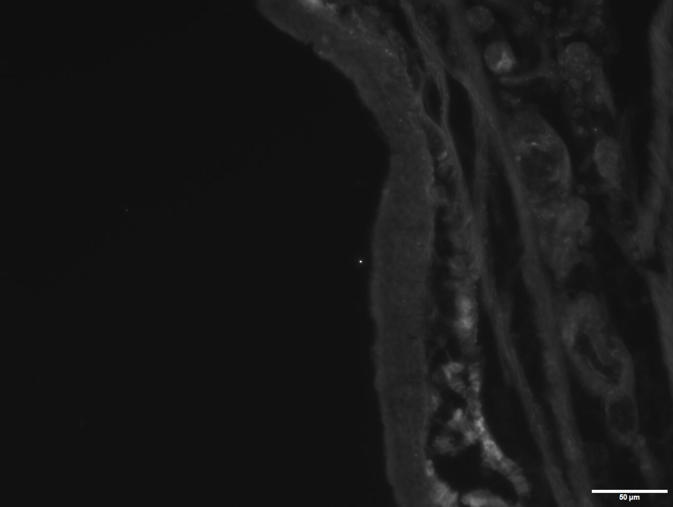 Human TSLP Antibody AF1398