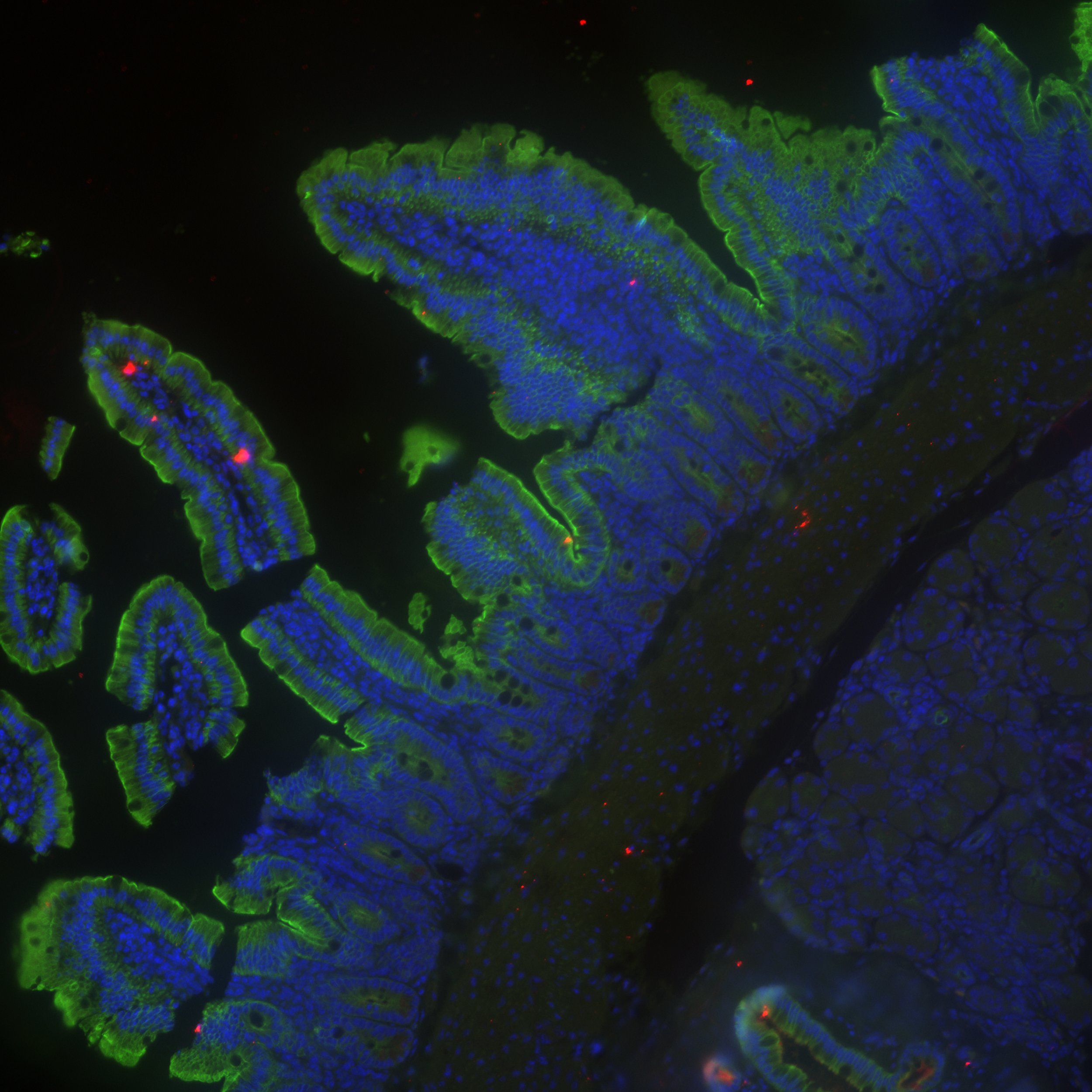 Mouse IL‑17E/IL‑25 Antibody AF1399
