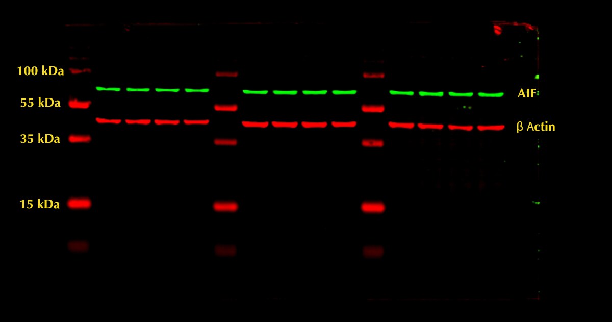 Human/Mouse/Rat AIF Antibody AF1457