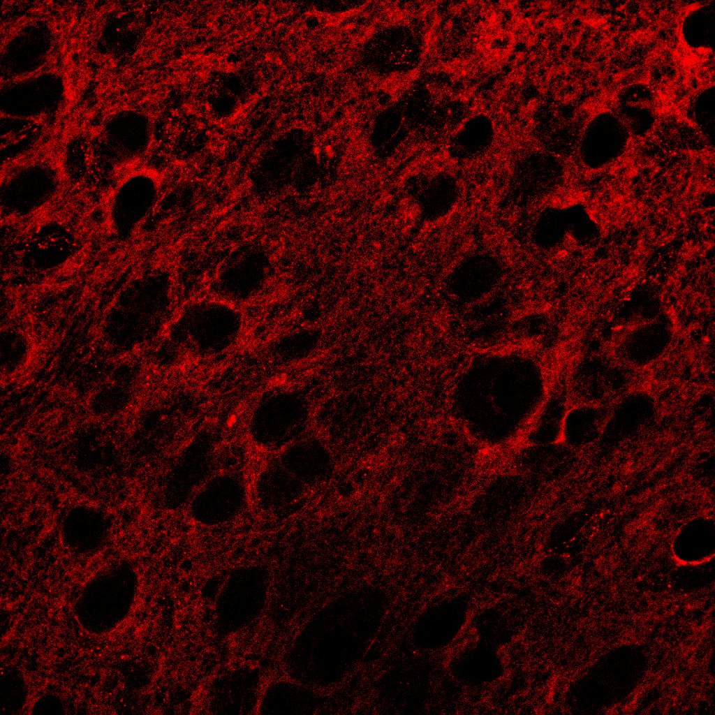 Human/Mouse/Rat TrkB Antibody AF1494