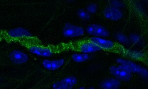 Mouse Podocalyxin Antibody AF1556