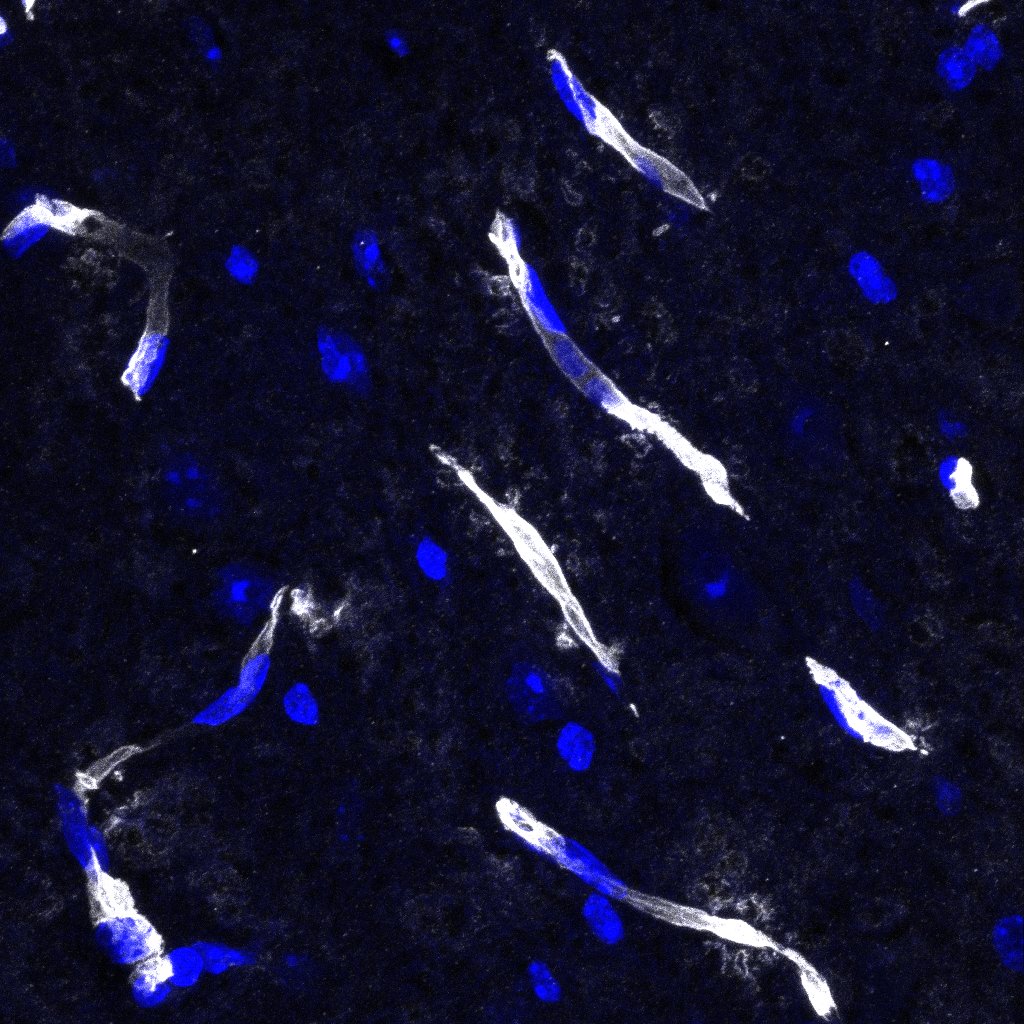 Mouse Podocalyxin Antibody AF1556