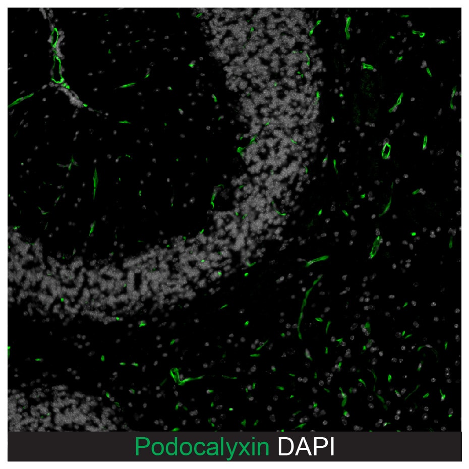 Mouse Podocalyxin Antibody AF1556