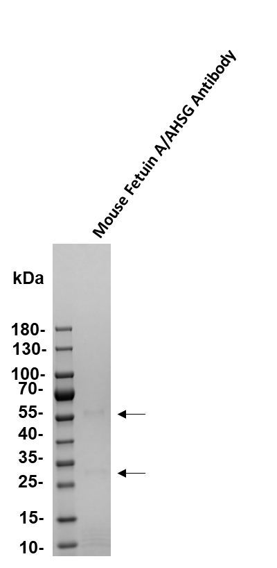 Mouse Fetuin A/AHSG Antibody AF1563