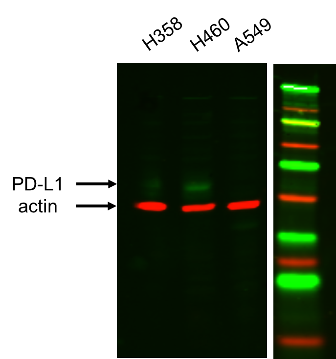 Human PD-L1/B7-H1 Antibody AF156