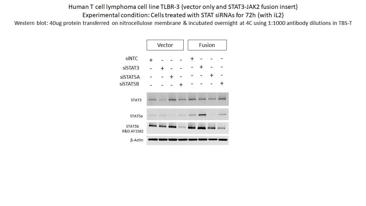 Human/Mouse STAT5b Antibody AF1584