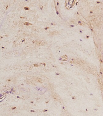 Mouse SOST/Sclerostin Antibody AF1589