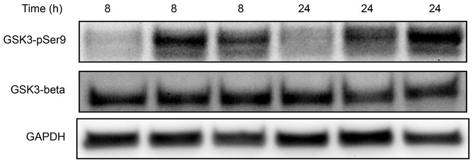 Human/Mouse/Rat Phospho-GSK‑3 alpha / beta  (S21/S9) Antibody AF1590
