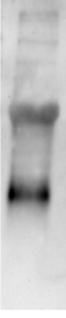 Human Kallikrein 11 Antibody AF1595