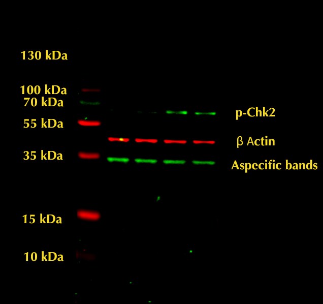 Human Phospho-Chk2 (T68) Antibody AF1626