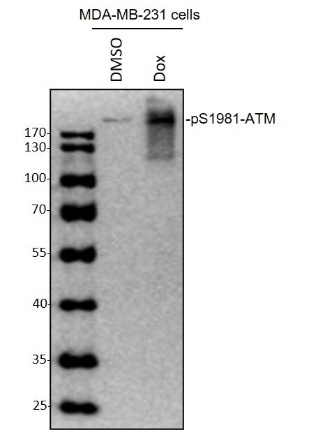Human/Mouse/Rat Phospho-ATM (S1981) Antibody AF1655