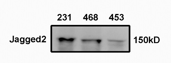 Human Jagged 2 Antibody AF1726