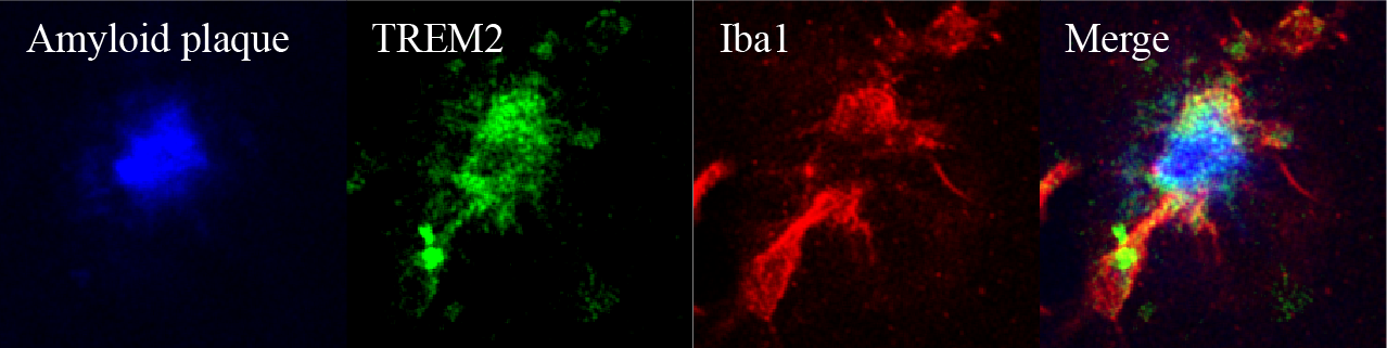 Mouse TREM2 Antibody AF1729
