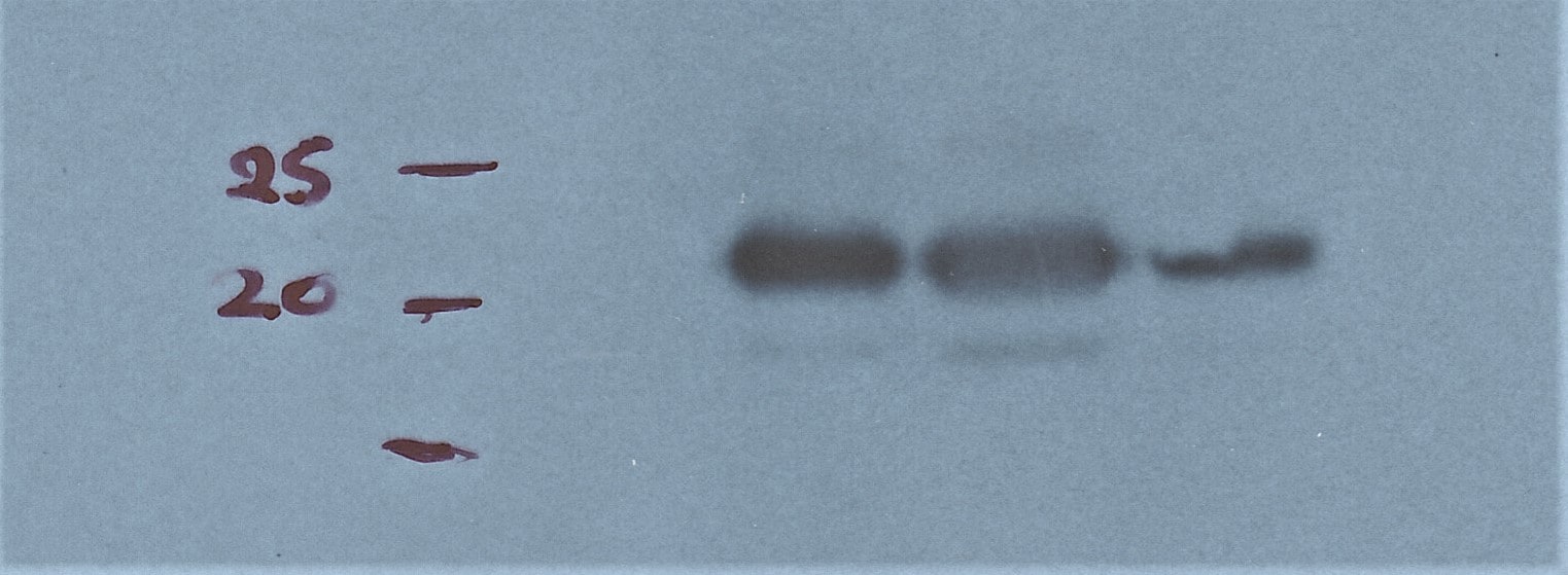 Human/Mouse/Rat Lipocalin‑2/NGAL Antibody AF1757