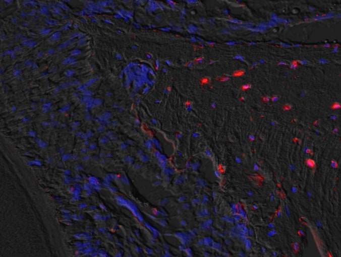 Mouse Dkk‑1 Antibody AF1765