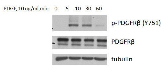 Human Phospho-PDGF R beta  (Y751) Antibody AF1767