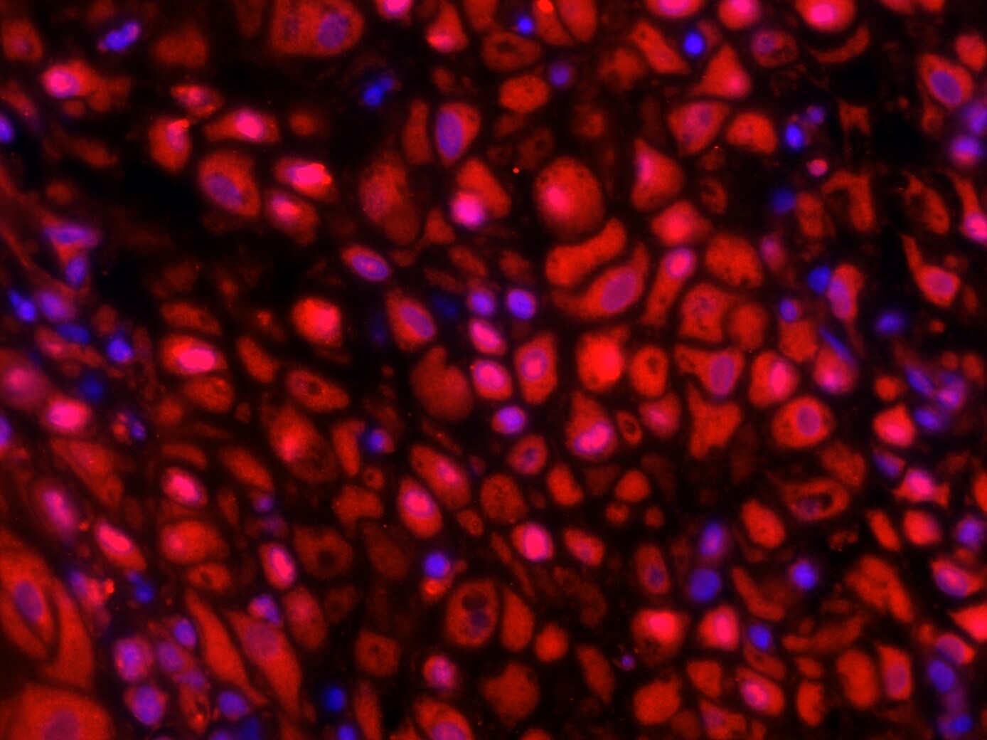 Human MMP‑16/MT3‑MMP Antibody AF1785