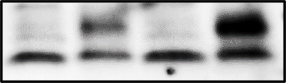 Human Endocan/ESM‑1 Antibody AF1810