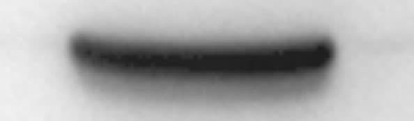 Mouse TIM‑1/KIM‑1/HAVCR Antibody AF1817