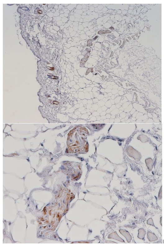 Human S100B Antibody AF1820