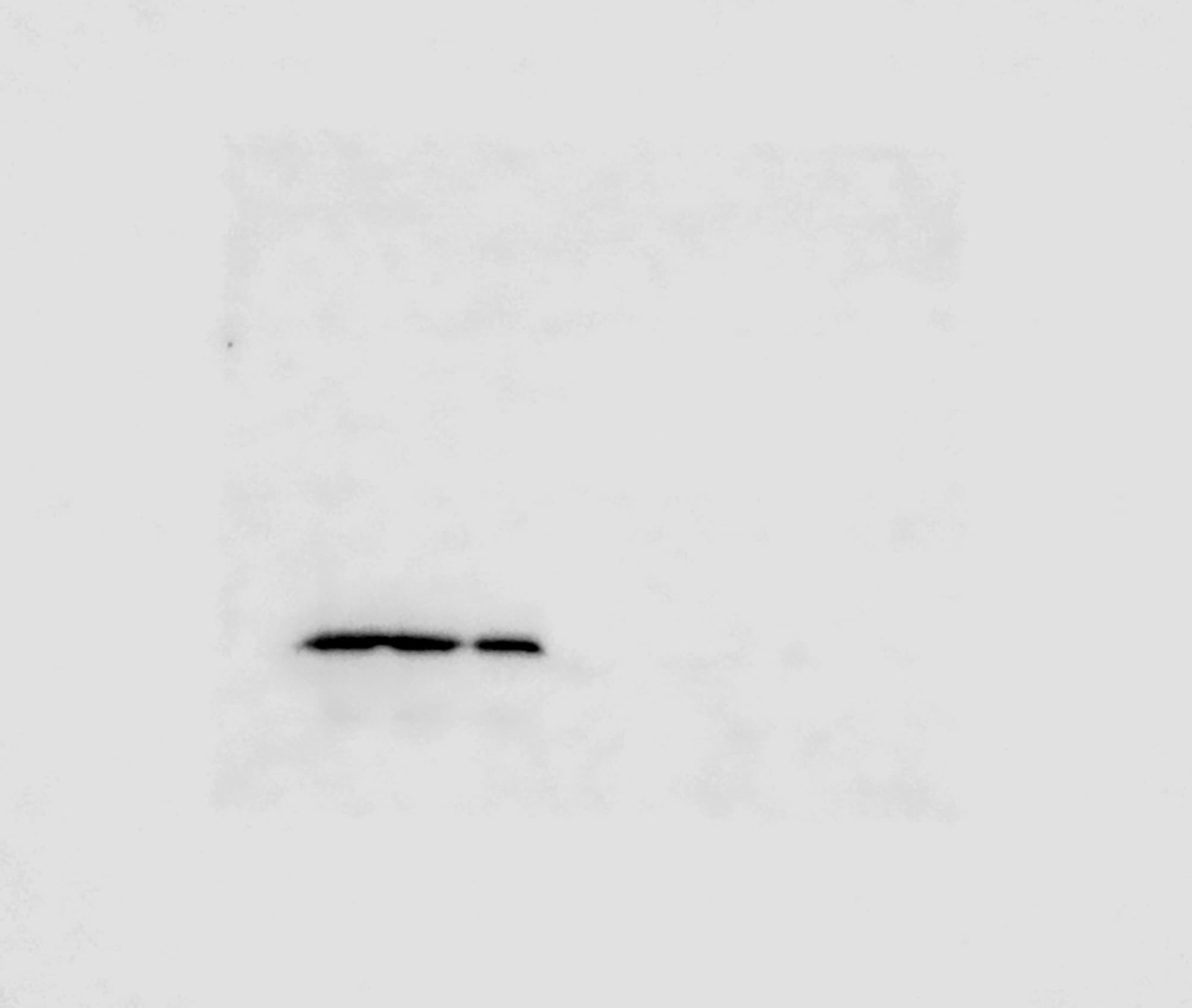 Human Complement Factor D/Adipsin Antibody AF1824