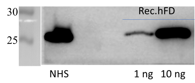 Human Complement Factor D/Adipsin Antibody AF1824