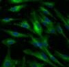 Human Pentraxin 3/TSG‑14 Antibody AF1826