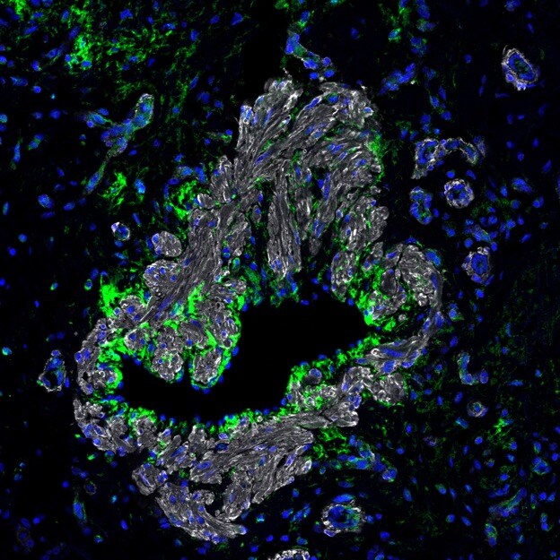 Human Pentraxin 3/TSG‑14 Antibody AF1826