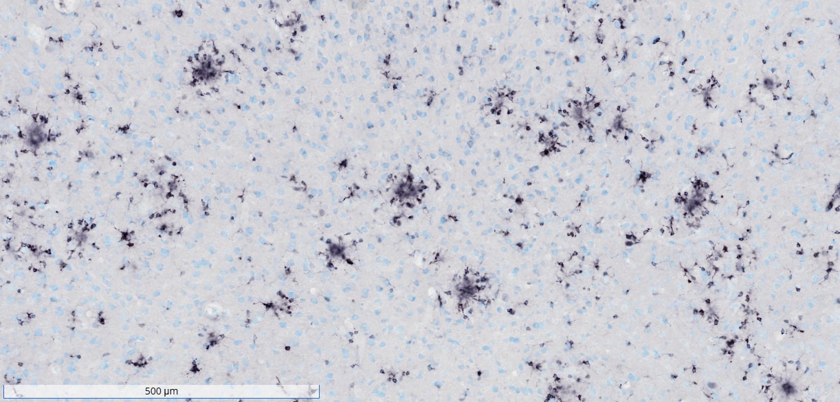 Human TREM2 Antibody AF18281