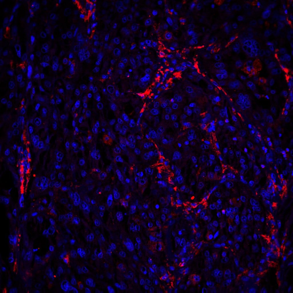 Human TREM2 Antibody AF1828