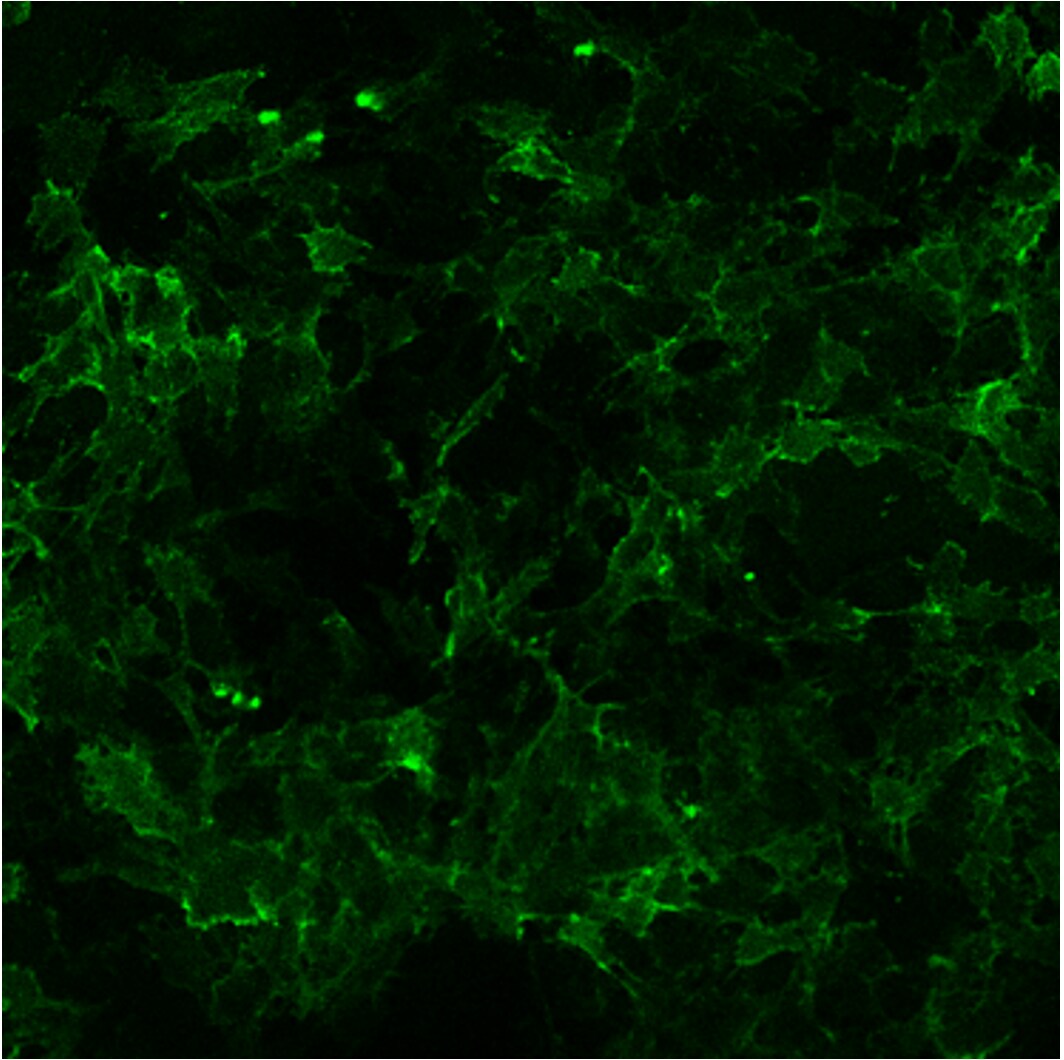 Human TREM2 Antibody AF1828
