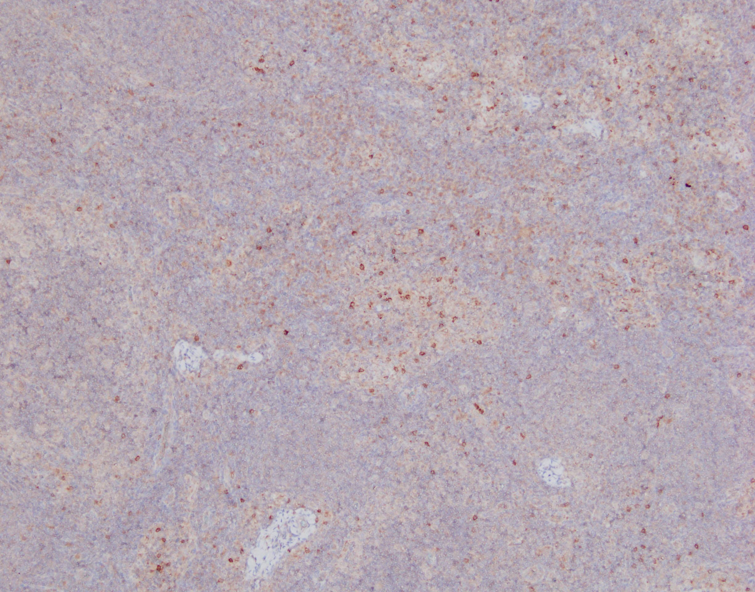 Human NKp46/NCR1 Antibody AF1850