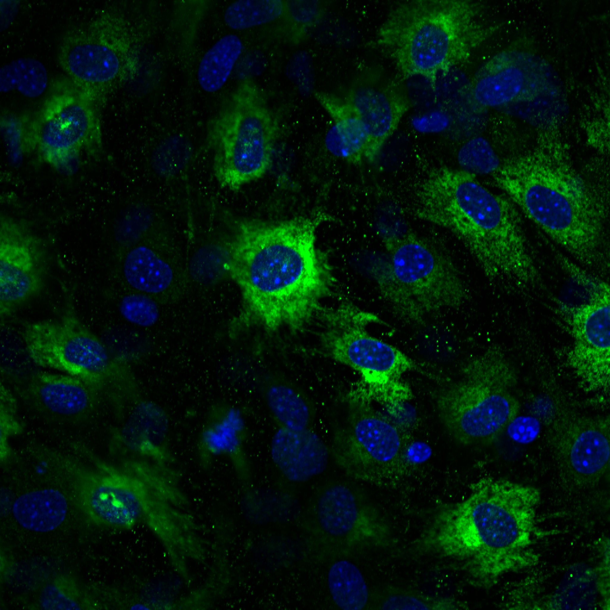 Mouse Lipocalin‑2/NGAL Antibody AF1857