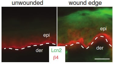 Mouse Lipocalin‑2/NGAL Antibody AF1857