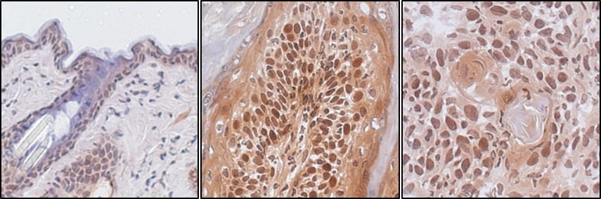 Mouse Lipocalin‑2/NGAL Antibody AF1857
