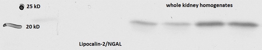 Mouse Lipocalin‑2/NGAL Antibody AF1857