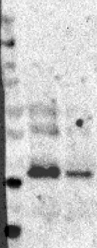 Mouse Lipocalin‑2/NGAL Antibody AF1857