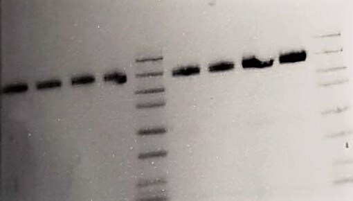 Human Integrin  alpha 5/CD49e Antibody AF1864