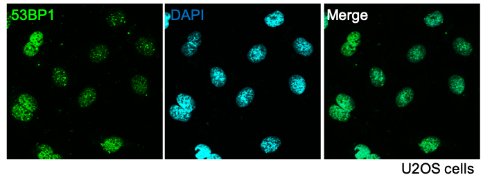 Human 53BP1 Antibody AF1877