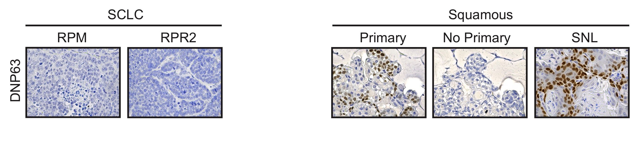 Human p63/TP73L Antibody AF1916