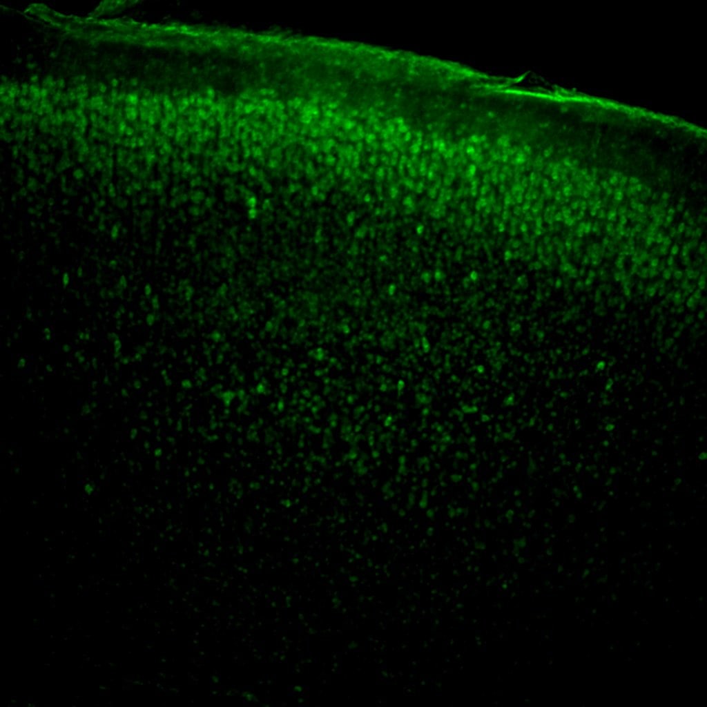 Human/Mouse/Rat HIF-1 alpha/HIF1A Antibody AF1935