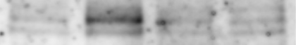 Human/Mouse/Rat HIF-1 alpha/HIF1A Antibody AF1935